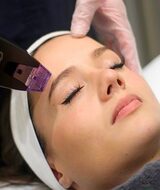 Book an Appointment with Morpheus8 - Prix selon zone at La clinique Versa MD situé à Montréal